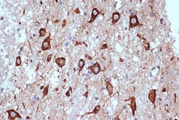Anti-PRKRA/PACT Antibody, clone 2W2E10, Rabbit Monoclonal