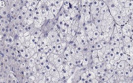 Anti-TrkA Antibody, clone 2J4 ZooMAb&#174; Rabbit Monoclonal recombinant, expressed in HEK 293 cells