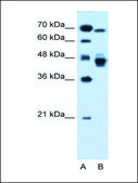 Anti-NR2F6 (AB2) antibody produced in rabbit affinity isolated antibody