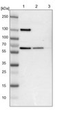 Anti-UPF3B antibody produced in rabbit Ab1, Prestige Antibodies&#174; Powered by Atlas Antibodies, affinity isolated antibody, buffered aqueous glycerol solution