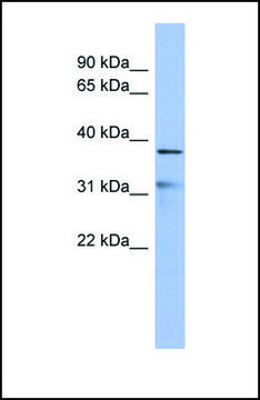 Anti-HEY2 antibody produced in rabbit affinity isolated antibody