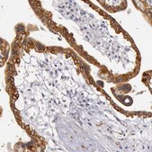 Anti-KRT18 antibody produced in rabbit Prestige Antibodies&#174; Powered by Atlas Antibodies, affinity isolated antibody, buffered aqueous glycerol solution
