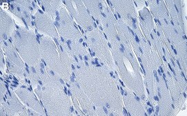 Anti-Hexokinase-2 Antibody, clone 1F3 ZooMAb&#174; Rabbit Monoclonal recombinant, expressed in HEK 293 cells