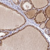Anti-TOR1AIP1 antibody produced in rabbit Prestige Antibodies&#174; Powered by Atlas Antibodies, affinity isolated antibody, buffered aqueous glycerol solution