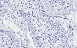 Anti-POLR2A Antibody, clone 3G21 ZooMAb&#174; Rabbit Monoclonal recombinant, expressed in HEK 293 cells