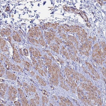 Anti-MYL12B antibody produced in rabbit Prestige Antibodies&#174; Powered by Atlas Antibodies, affinity isolated antibody, buffered aqueous glycerol solution
