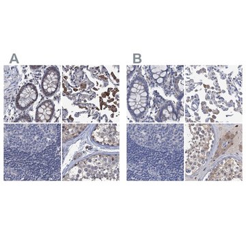 Anti-RTKN2 antibody produced in rabbit Prestige Antibodies&#174; Powered by Atlas Antibodies, affinity isolated antibody, buffered aqueous glycerol solution