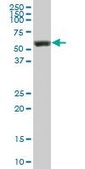 Anti-LYN antibody produced in mouse purified immunoglobulin, buffered aqueous solution