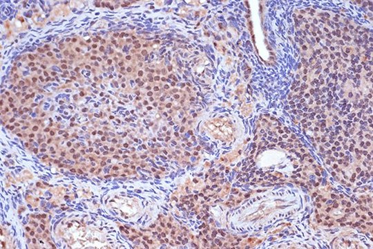 Anti-MSH2 antibody produced in rabbit