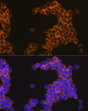 Anti-CD30 Antibody, clone 8N4G5, Rabbit Monoclonal