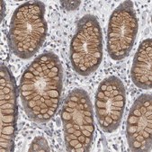 Anti-MSRA antibody produced in rabbit Prestige Antibodies&#174; Powered by Atlas Antibodies, affinity isolated antibody, buffered aqueous glycerol solution