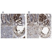 Anti-HIP1 antibody produced in rabbit Prestige Antibodies&#174; Powered by Atlas Antibodies, affinity isolated antibody, buffered aqueous glycerol solution
