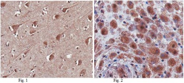 Anti-SAPAP1 Antibody from rabbit, purified by affinity chromatography