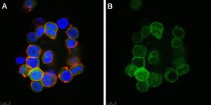 Anti-Anosmin Antibody, clone 2C17 ZooMAb&#174; Rabbit Monoclonal recombinant, expressed in HEK 293 cells