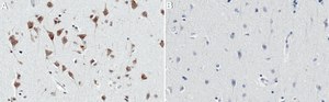 Anti-ALK Antibody, clone 1D13 ZooMAb&#174; Rabbit Monoclonal recombinant, expressed in HEK 293 cells