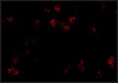 Anti-CD81 antibody produced in rabbit affinity isolated antibody, buffered aqueous solution