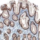 Monoclonal Anti-OCLN antibody produced in mouse Prestige Antibodies&#174; Powered by Atlas Antibodies, clone CL1555, purified immunoglobulin, buffered aqueous glycerol solution