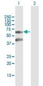Anti-TTBK2 antibody produced in mouse purified immunoglobulin, buffered aqueous solution
