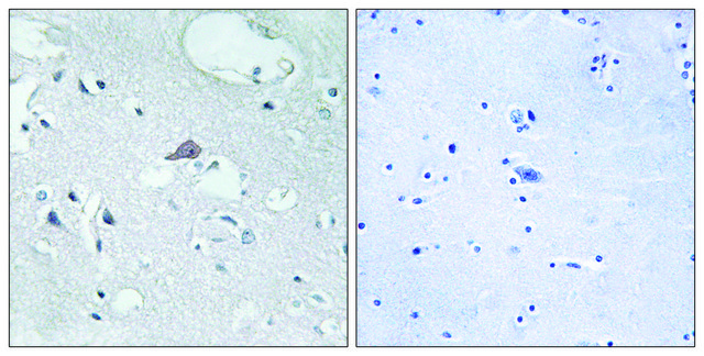 Anti-OPRM1 antibody produced in rabbit affinity isolated antibody