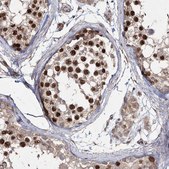 Anti-PRC1 antibody produced in rabbit Prestige Antibodies&#174; Powered by Atlas Antibodies, affinity isolated antibody, buffered aqueous glycerol solution