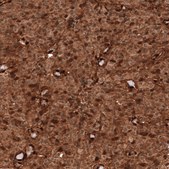 Monoclonal Anti-PTEN antibody produced in mouse Prestige Antibodies&#174; Powered by Atlas Antibodies, clone CL11722, purified immunoglobulin, buffered aqueous glycerol solution