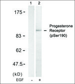 Anti-phospho-PGR (pSer190) antibody produced in rabbit affinity isolated antibody