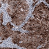 Anti-WFDC2 antibody produced in mouse Prestige Antibodies&#174; Powered by Atlas Antibodies, clone CL12917, purified by using Protein A, buffered aqueous glycerol solution