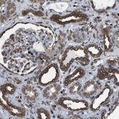 Anti-APMAP antibody produced in rabbit Prestige Antibodies&#174; Powered by Atlas Antibodies, affinity isolated antibody, buffered aqueous glycerol solution