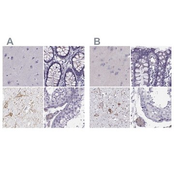 Anti-CALCR antibody produced in rabbit Prestige Antibodies&#174; Powered by Atlas Antibodies, affinity isolated antibody, buffered aqueous glycerol solution