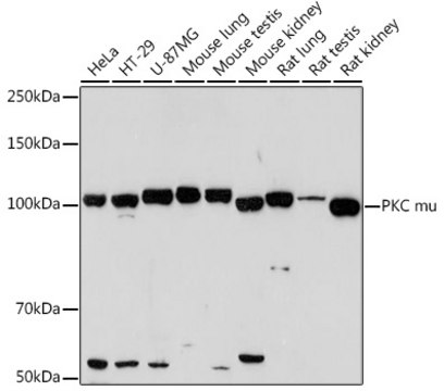 Anti-PKC mu Antibody, clone 2A5U1, Rabbit Monoclonal