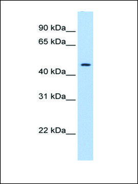 Anti-SerPINE1 (AB2) antibody produced in rabbit affinity isolated antibody