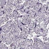 Anti-PDCD1 antibody produced in rabbit Prestige Antibodies&#174; Powered by Atlas Antibodies, affinity isolated antibody, buffered aqueous glycerol solution