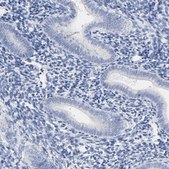 Anti-ACPP antibody produced in rabbit Prestige Antibodies&#174; Powered by Atlas Antibodies, affinity isolated antibody, buffered aqueous glycerol solution
