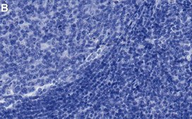 Anti-DNMT1 Antibody, clone 1L14 ZooMAb&#174; Rabbit Monoclonal recombinant, expressed in HEK 293 cells
