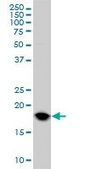 Monoclonal Anti-UBE2C antibody produced in mouse clone 9D3, purified immunoglobulin, buffered aqueous solution