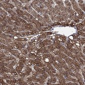 Anti-ALDH7A1 antibody produced in rabbit Prestige Antibodies&#174; Powered by Atlas Antibodies, affinity isolated antibody, buffered aqueous glycerol solution