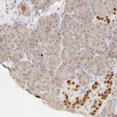 Anti-NKX2-2 antibody produced in rabbit Prestige Antibodies&#174; Powered by Atlas Antibodies, affinity isolated antibody, buffered aqueous glycerol solution