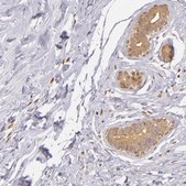 Anti-IMPDH2 antibody produced in rabbit Prestige Antibodies&#174; Powered by Atlas Antibodies, affinity isolated antibody, buffered aqueous glycerol solution