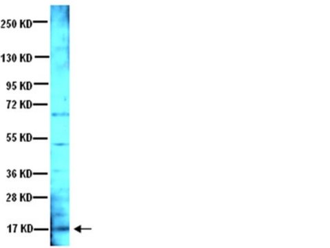 Anti-Brain Derived Neurotrophic Factor Antibody serum, Chemicon&#174;