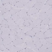 Anti-DDX20 antibody produced in rabbit Prestige Antibodies&#174; Powered by Atlas Antibodies, affinity isolated antibody, buffered aqueous glycerol solution