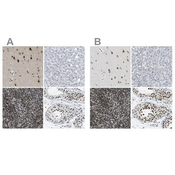 Anti-FOXK1 antibody produced in rabbit Prestige Antibodies&#174; Powered by Atlas Antibodies, affinity isolated antibody, buffered aqueous glycerol solution