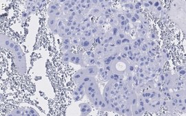 Anti-PPAR&#947; Antibody, clone 1I19 ZooMAb&#174; Rabbit Monoclonal recombinant, expressed in HEK 293 cells