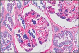 PAS TISSUE-TROL&#8482; Control Slides from human kidney
