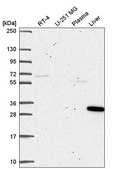 Anti-SQSTM1 antibody produced in rabbit Prestige Antibodies&#174; Powered by Atlas Antibodies, affinity isolated antibody