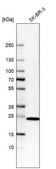 Anti-DHRS2 antibody produced in rabbit Prestige Antibodies&#174; Powered by Atlas Antibodies, affinity isolated antibody
