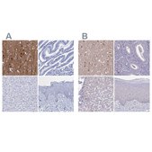 Anti-FBXL16 antibody produced in rabbit Prestige Antibodies&#174; Powered by Atlas Antibodies, affinity isolated antibody, buffered aqueous glycerol solution