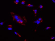 SK-MEL-147 Human Melanoma Cell Line&nbsp;