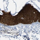 Anti-SFN antibody produced in rabbit Prestige Antibodies&#174; Powered by Atlas Antibodies, affinity isolated antibody, buffered aqueous glycerol solution