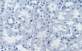 Anti-TFG Antibody, clone 1F9 ZooMAb&#174; Rabbit Monoclonal recombinant, expressed in HEK 293 cells