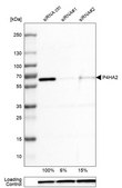 Monoclonal Anti-P4HA2 antibody produced in mouse clone CL0351, Prestige Antibodies&#174; Powered by Atlas Antibodies, purified immunoglobulin, buffered aqueous glycerol solution